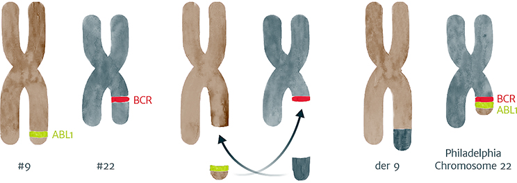 A diagrammatic representation of the BCR and ABL1 genes swapping