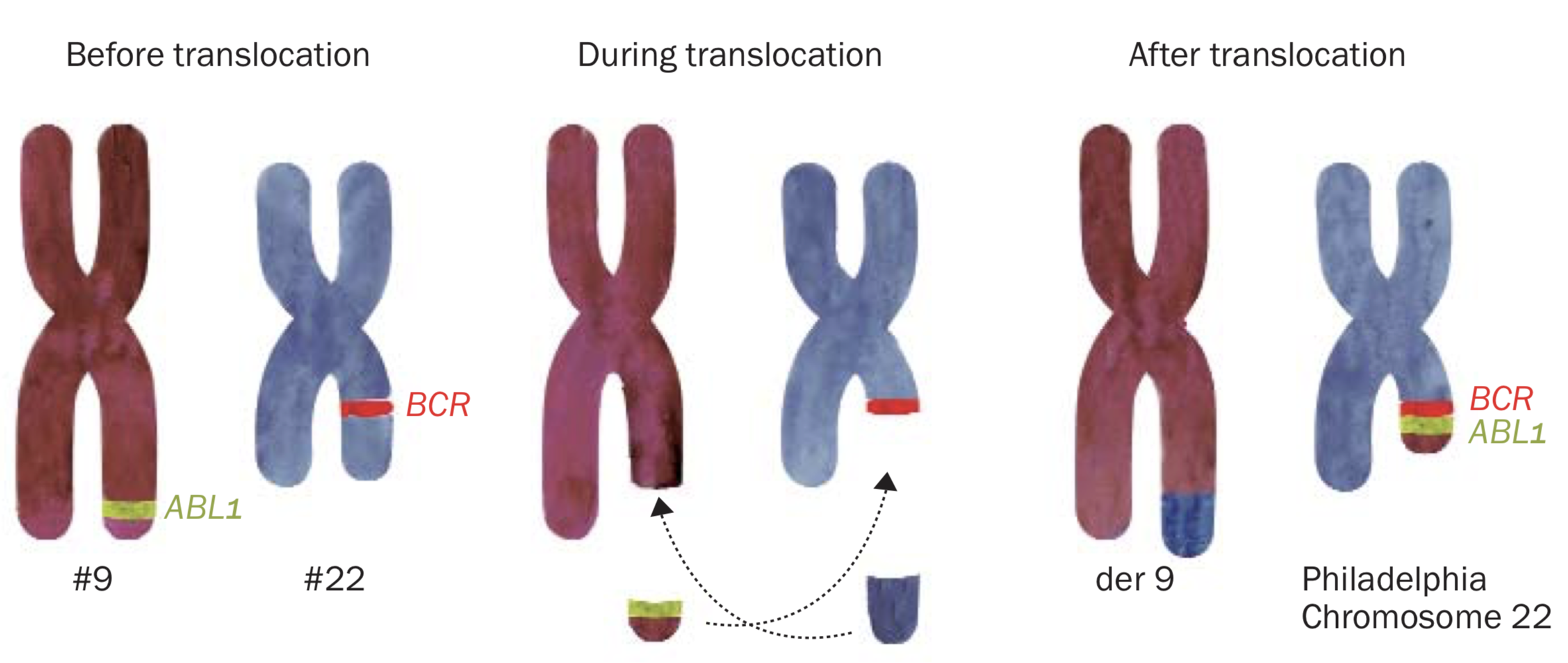 Diagram of CML translocation